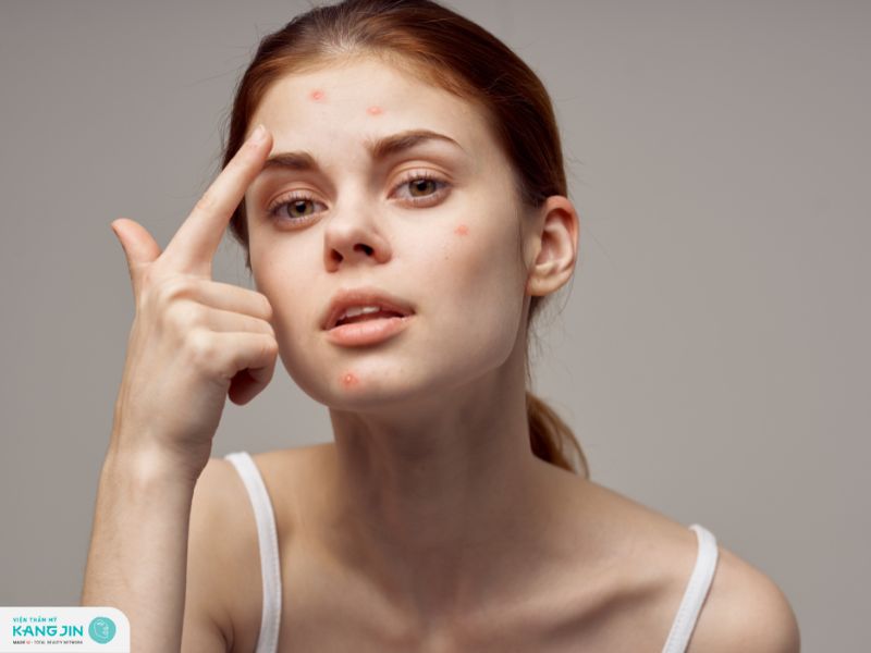 các bệnh về da mùa hè thường gặp