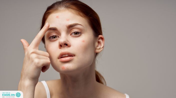 các bệnh về da mùa hè thường gặp