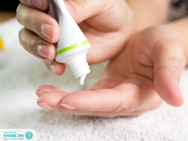 Sử dụng kem hoặc thuốc bôi đặc trị tăng sắc tố sau viêm