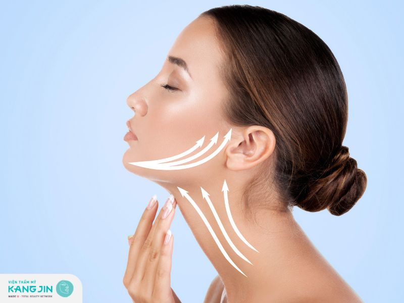 Khắc phục má bị hóp bằng phương pháp căng chỉ collagen