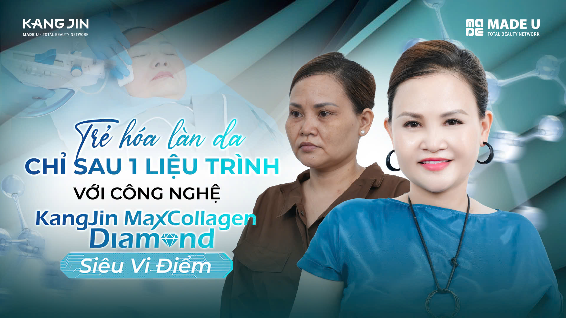 chi-phuong-ha-sau-1-lieu-trinh-tre-hoa