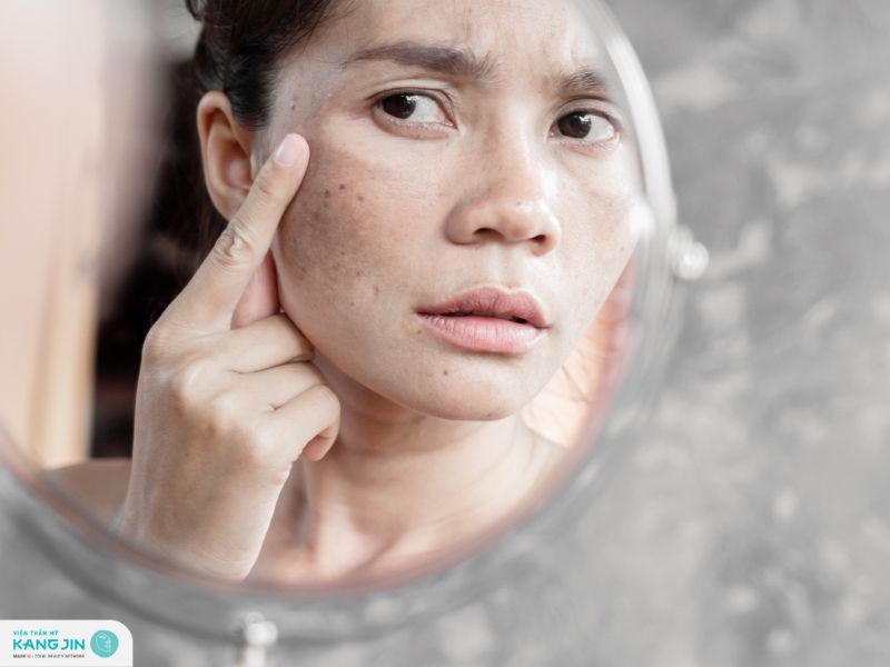 da nổi đốm nâu không ngứa