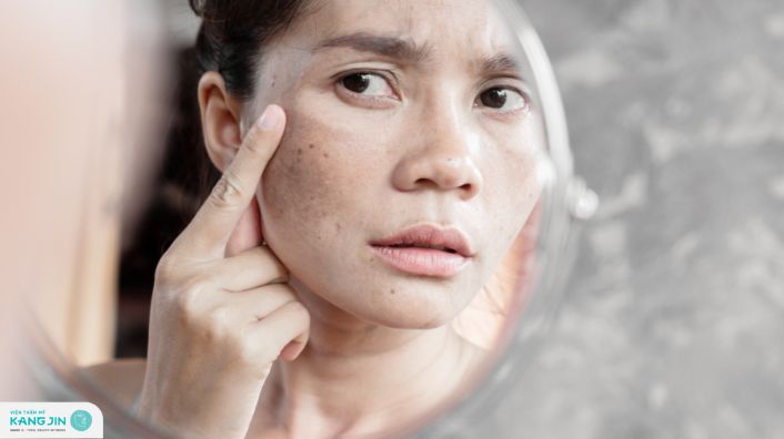 da nổi đốm nâu không ngứa