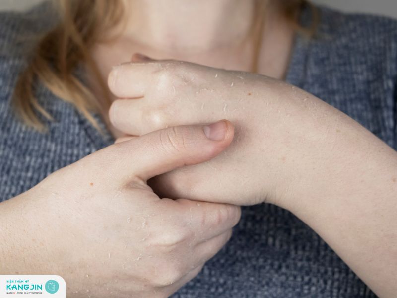 da tay bị bong tróc do thiếu chất gì