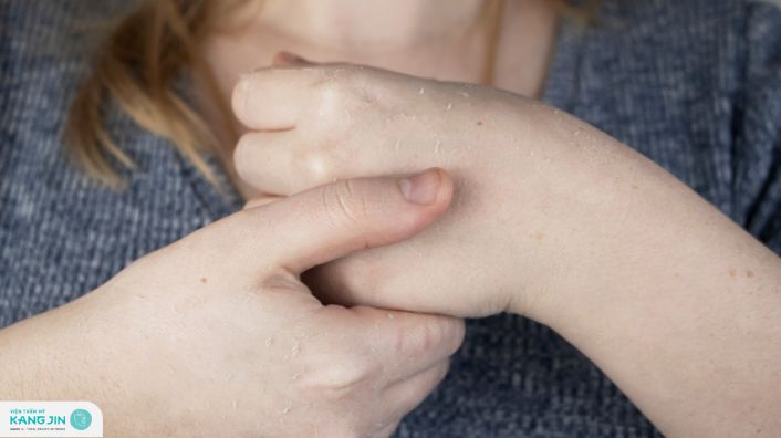 da tay bị bong tróc do thiếu chất gì