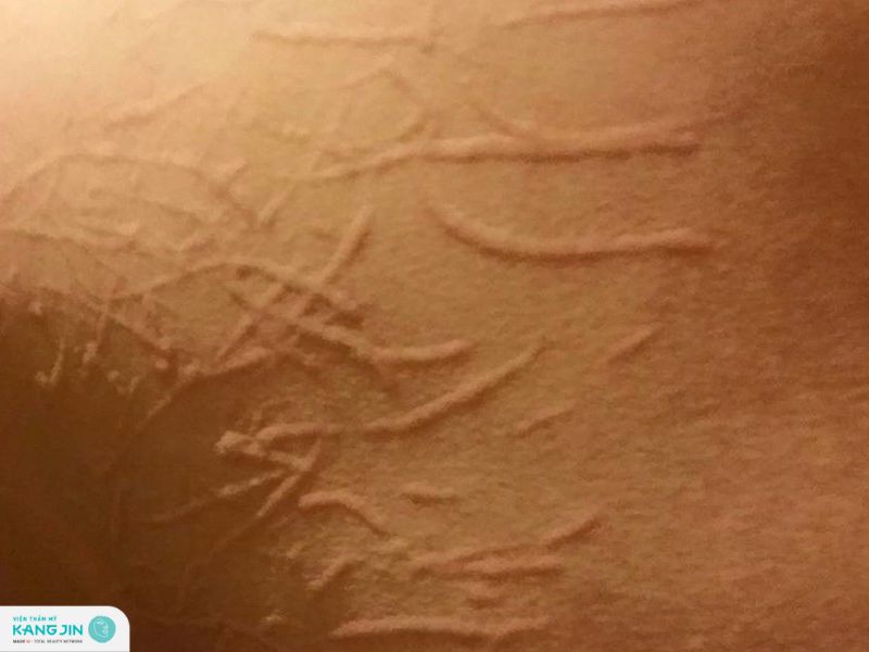 da vẽ nổi là gì