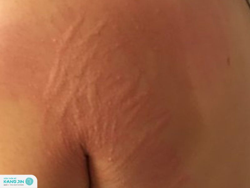 da vẽ nổi là gì