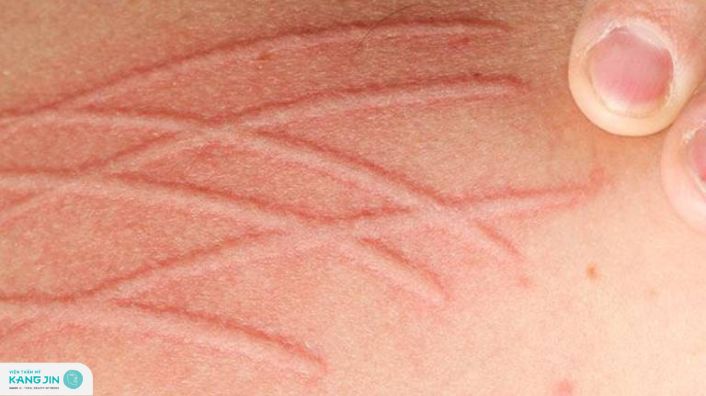 da vẽ nổi là gì