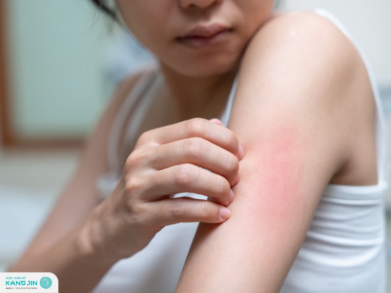 dấu hiệu da bị bào mòn