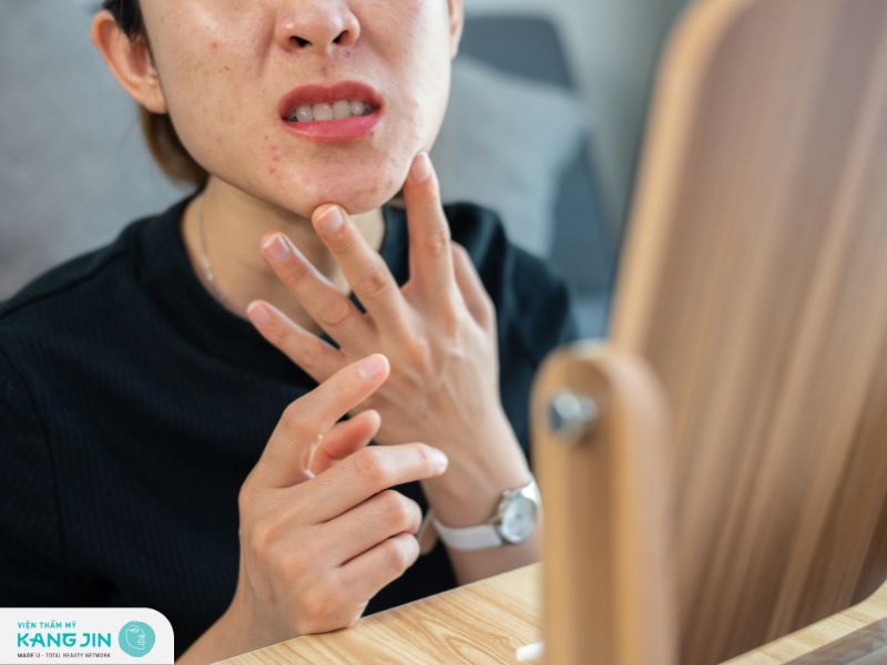 Dấu hiệu da bị kích ứng mỹ phẩm mà bạn nên biết 