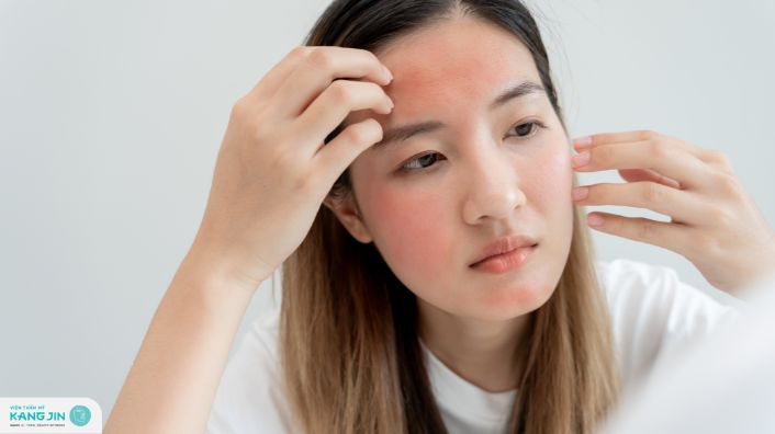dấu hiệu bị dị ứng da mặt thời tiết