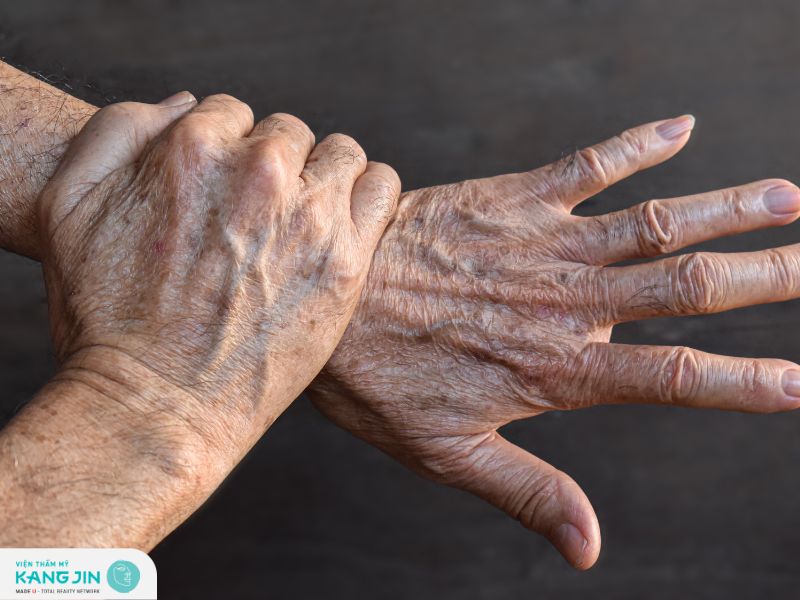 Đồi mồi là gì