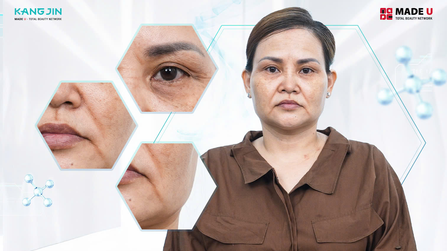 Làn da lão hóa sớm của chị Phương Hà