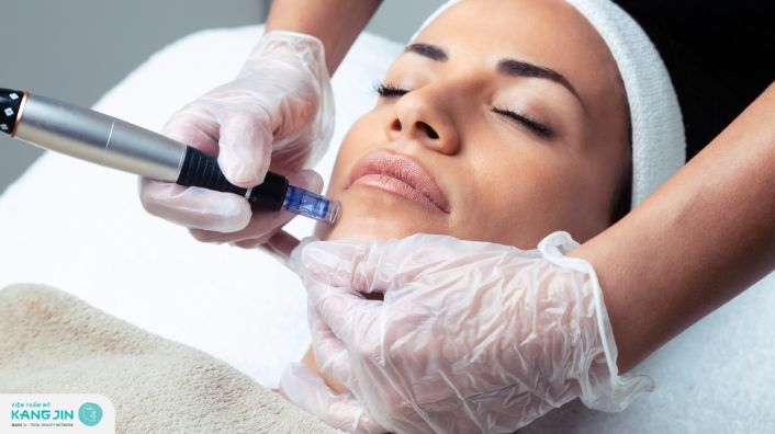Lăn kim là gì? Có tác dụng như thế nào đối với làn da?