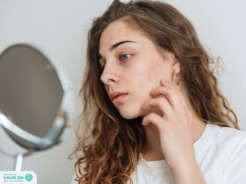 nguy cơ mắc bệnh về da mùa đông