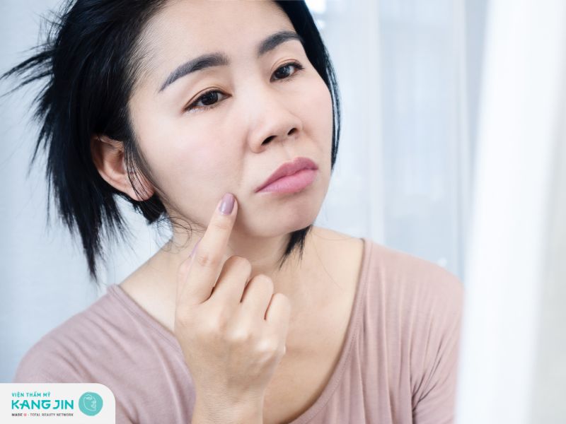 Nguyên nhân hình thành nếp nhăn khóe miệng