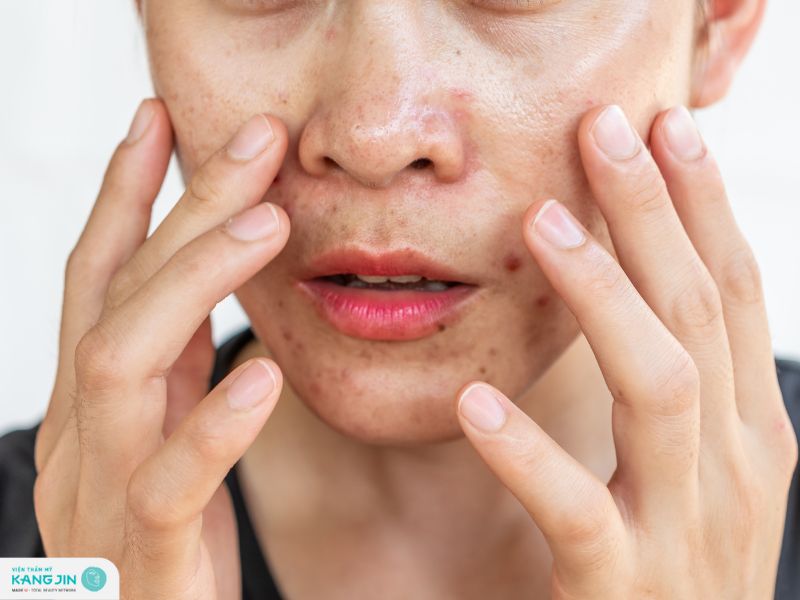 nguyên nhân khiến da đổ dầu sau khi ngủ dậy