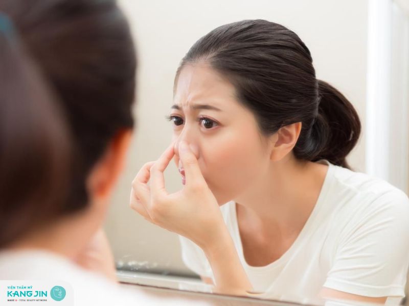 nguyên nhân và cách điều trị sợi bã nhờn