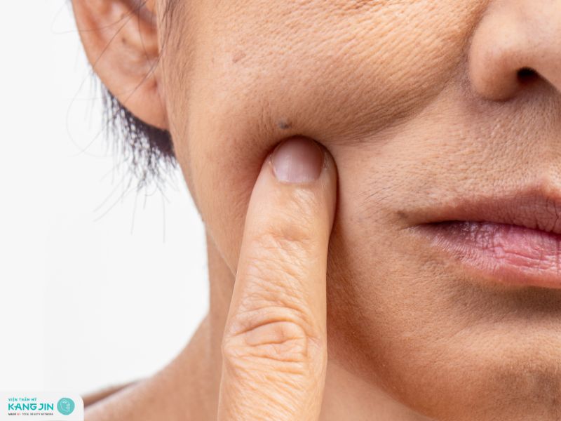 những điều xảy ra với làn da khi bạn già đi