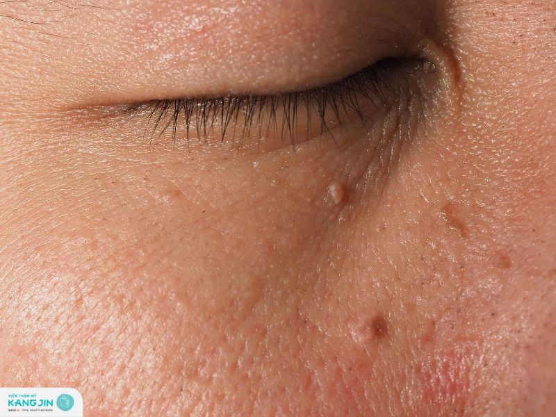 những điều xảy ra với làn da khi bạn già đi