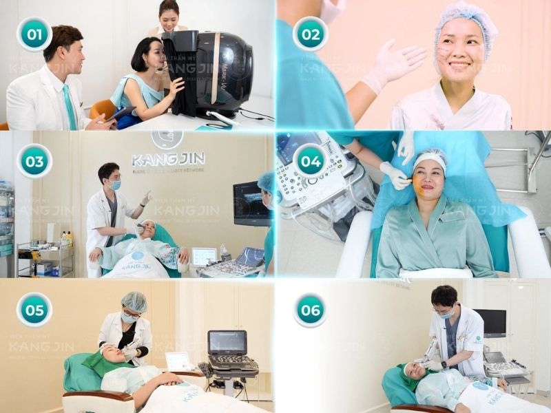 quy trình thực hiện liệu pháp KangJin Maxcollagen siêu vi điểm