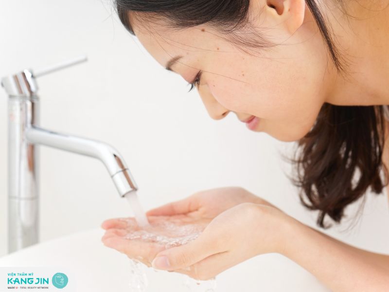 Rửa mặt nhẹ nhàng với nước sạch sau nặn mụn để làm dịu da