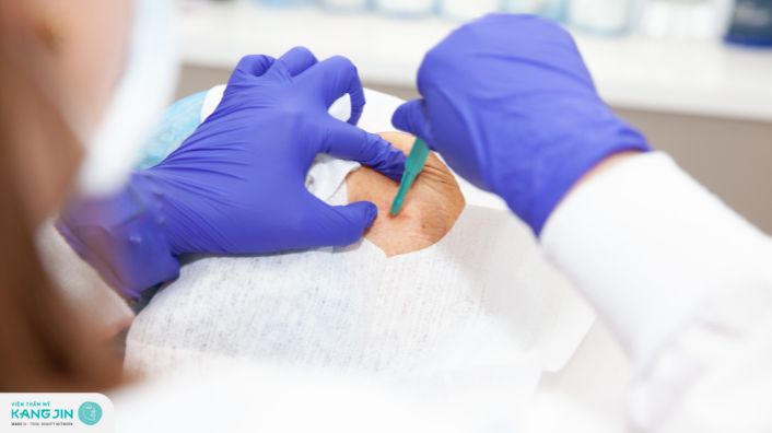 Sinh thiết da là gì? Quy trình, mục đích và khi nào nên thực hiện?