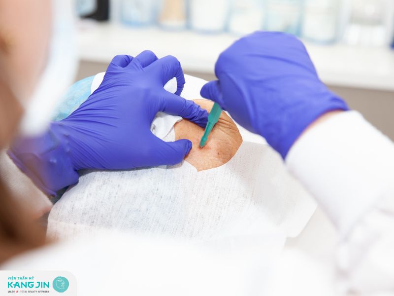 Sinh thiết da là gì