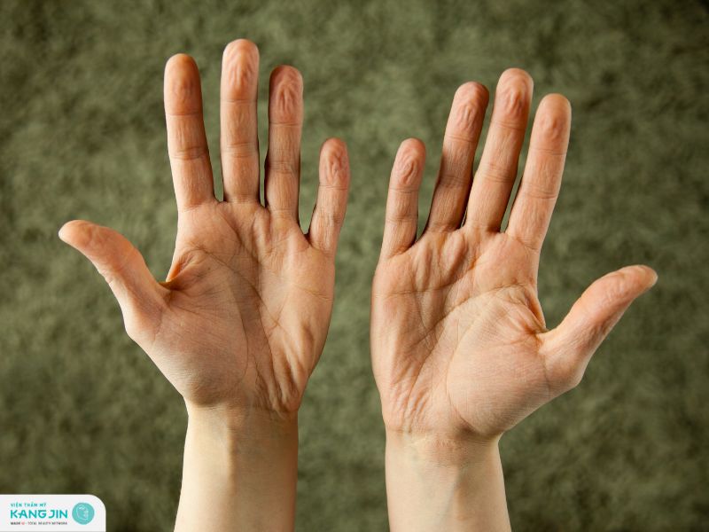 tại sao da tay bị nhăn khi gặp nước