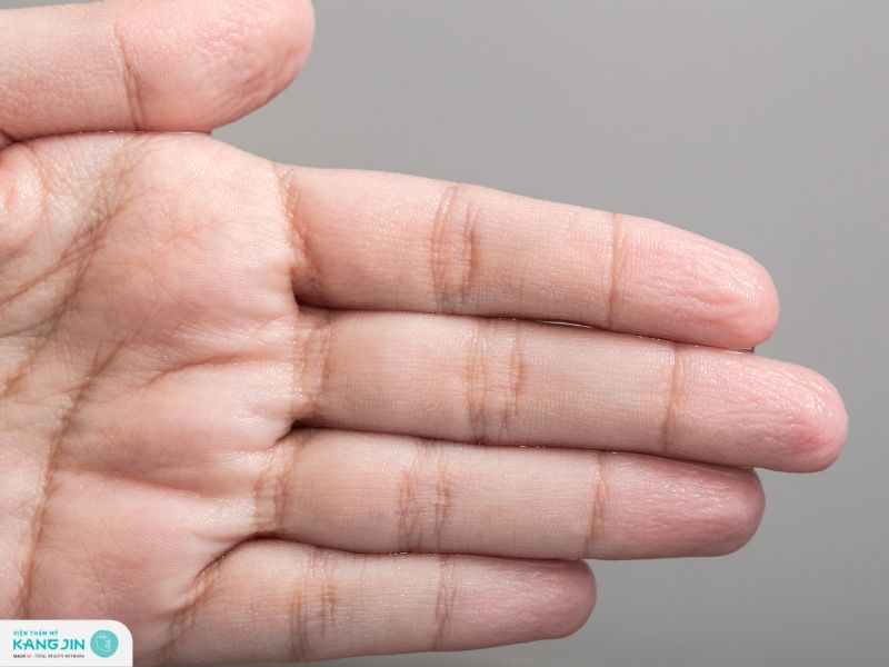 tại sao da tay bị nhăn khi gặp nước