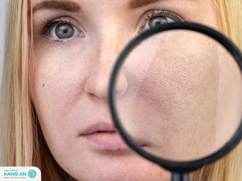 tại sao lỗ chân lông to