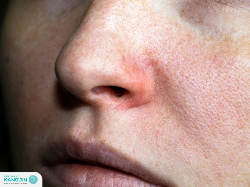 tại sao lỗ chân lông to