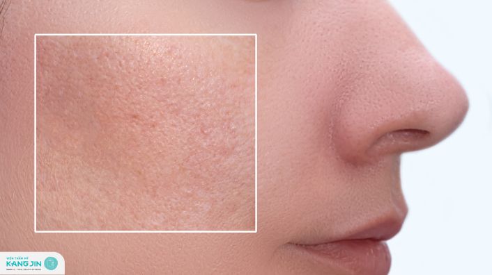 tại sao lỗ chân lông to