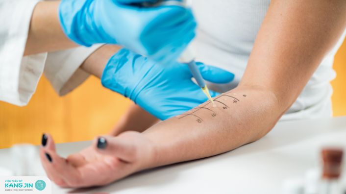 Test lẩy da nhằm mục đích gì? Ai nên và không nên thực hiện