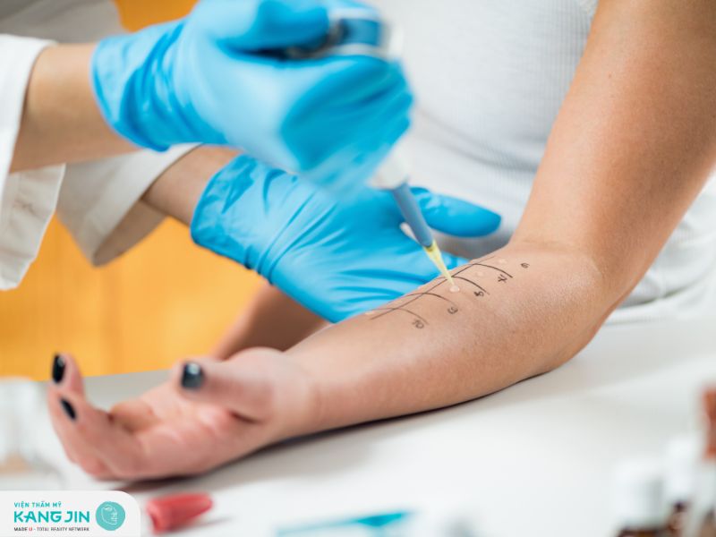 Test lẩy da nhằm mục đích gì?