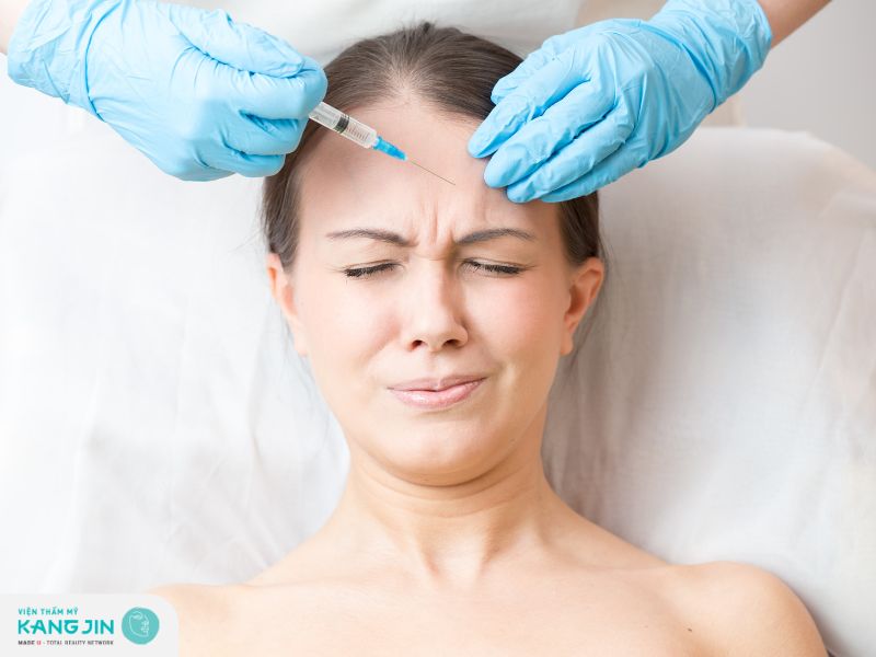 Tiêm Botox xóa nếp nhăn trán
