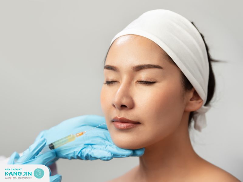 Tiêm filler làm đầy má hóp