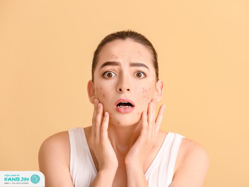 vết thâm mụn mãi không hết phải làm sao