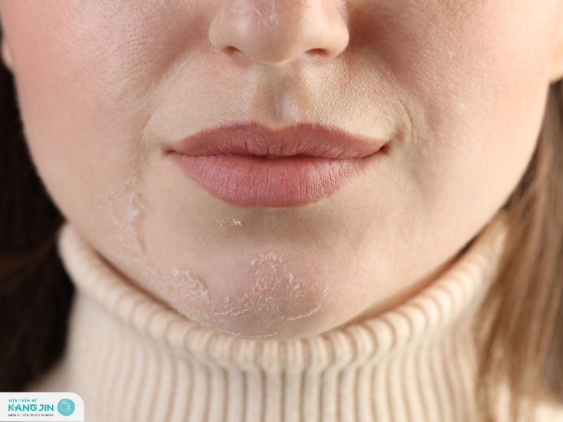 vì sao da mất dần tính đàn hồi theo thời gian