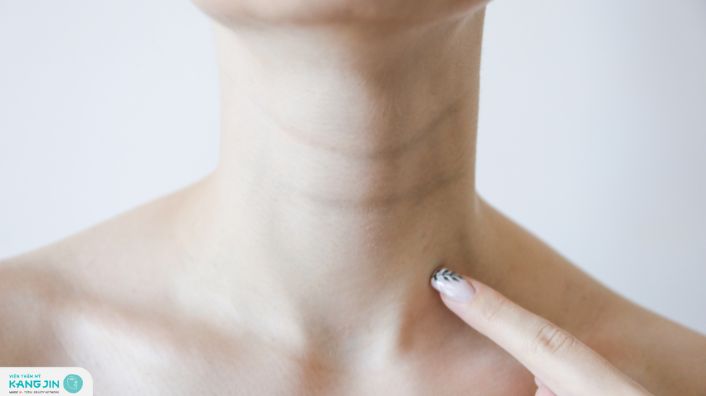 xóa nếp nhăn ở cổ