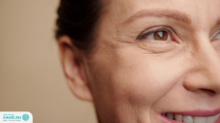 Xóa nếp nhăn vùng mắt không phẫu thuật: Bí quyết thoát khỏi bóng ma tuổi tác