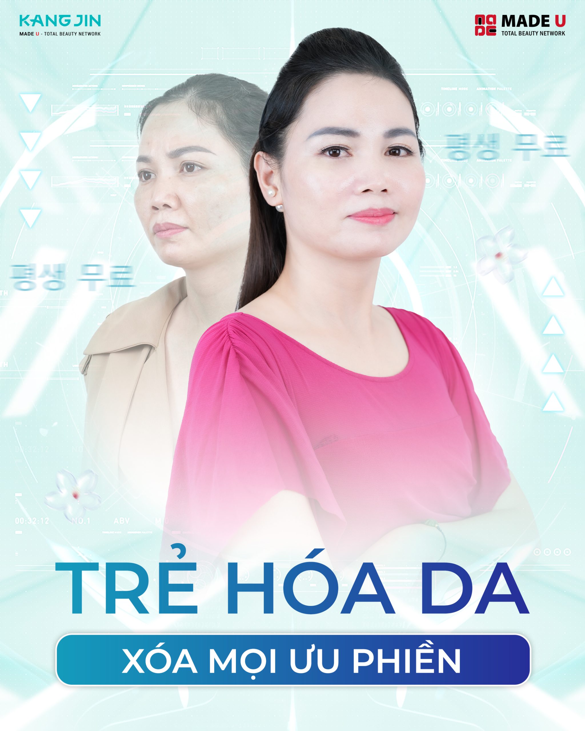 Chị Lê Dung xóa mọi ưu phiền sau khi trẻ hóa da tại KangJin 