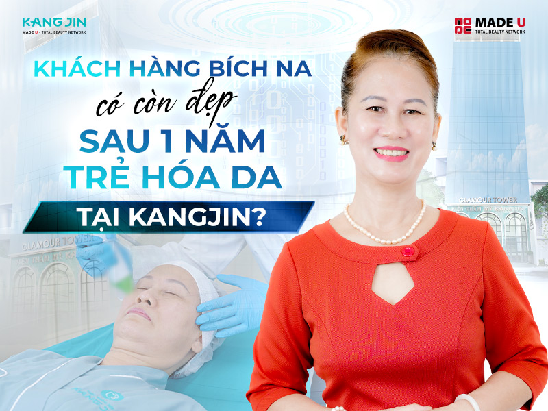 Khách hàng Bích Na có còn đẹp sau 1 năm trẻ hóa da tại KangJin?