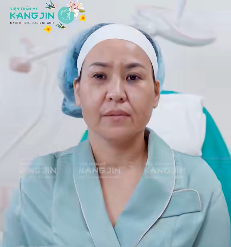 Tình trạng da lão hóa nặng của chị Ngọc Hà 