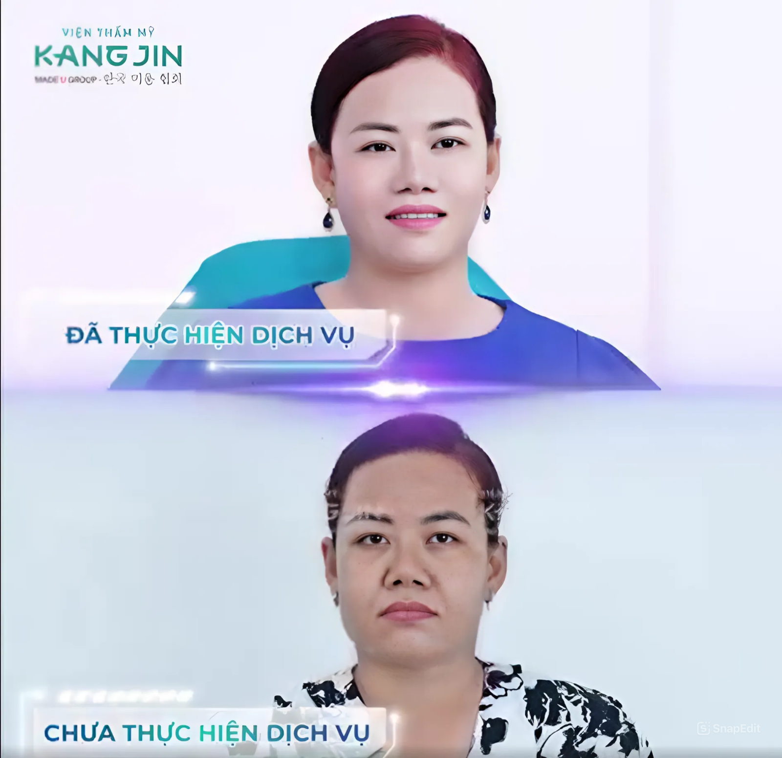 Chị Phương Nhi sau khi trẻ hóa da