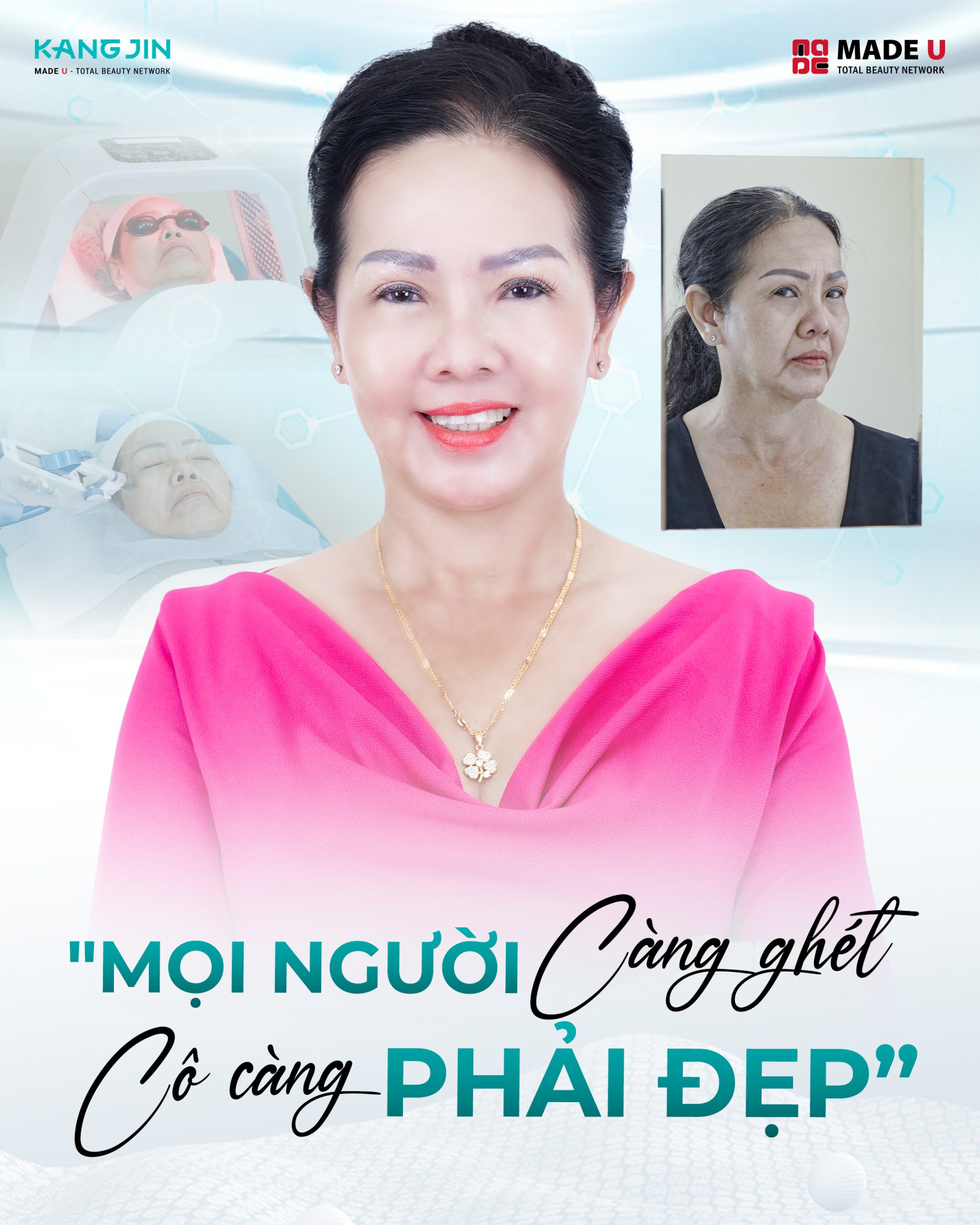 Hành trình "lột xác" của cô Chloe Quỳnh sau lần thất bại làm đẹp tại Đức