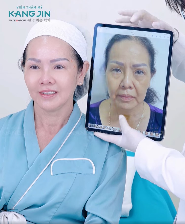 hình ảnh cô Chloe Quỳnh sau trẻ hóa