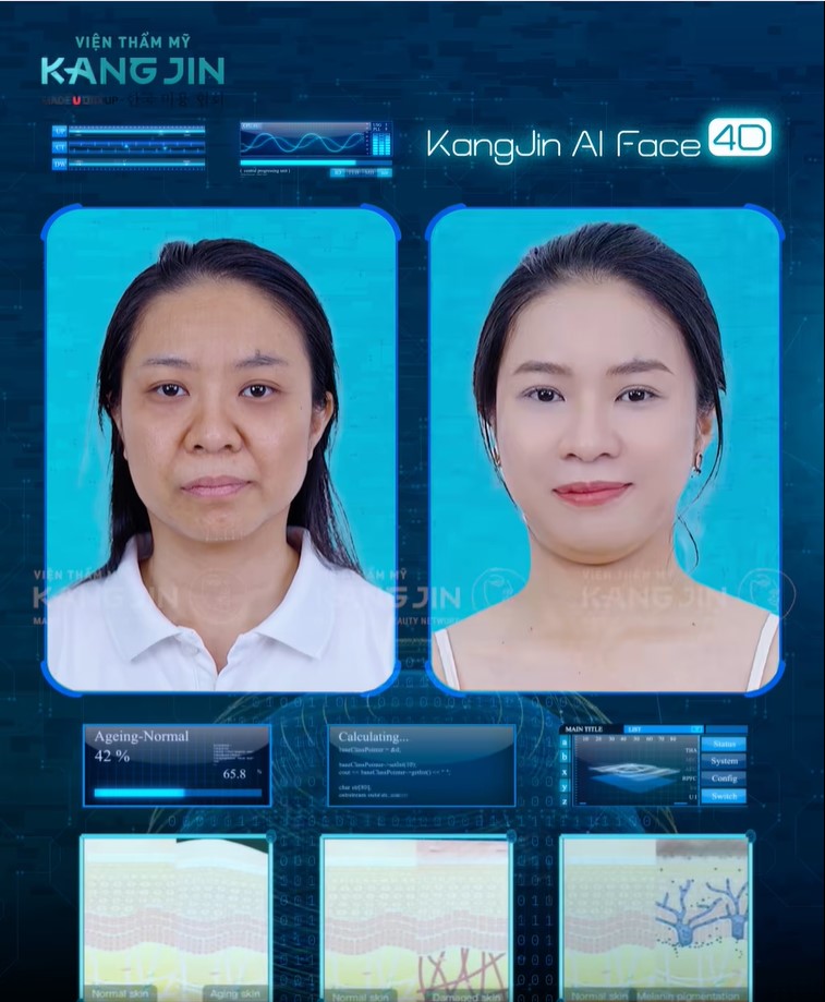 làn da của Thảo Vy Trước và sau liệu trình 