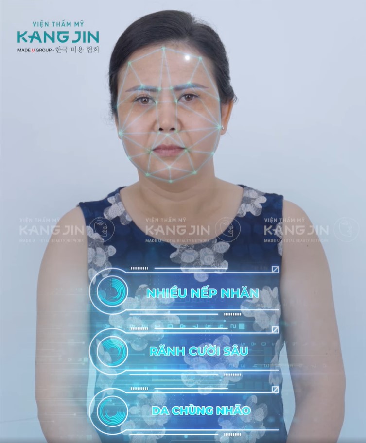 làn da lão hóa trầm trọng