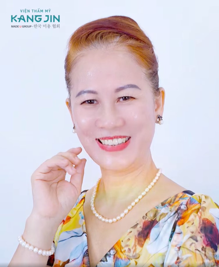 cô Bích Na sau liệu trình